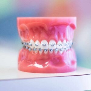 Braces & Invisalign Treatment