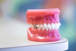 Braces & Invisalign Treatment