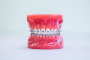 Braces & Invisalign Treatment