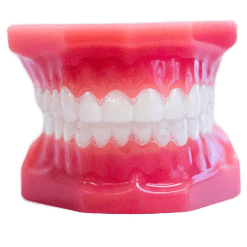 clear aligners on model